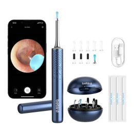 Smart Visual Ear-Clean Rod Bebird M9 S (sinine)